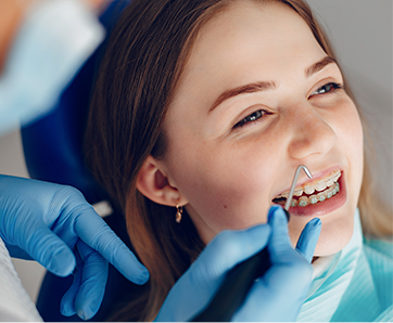 Adolescente esta en su revision periodica del tratamiento de ortodoncia estetico que tiene instalado en ambas arcadas de dientes