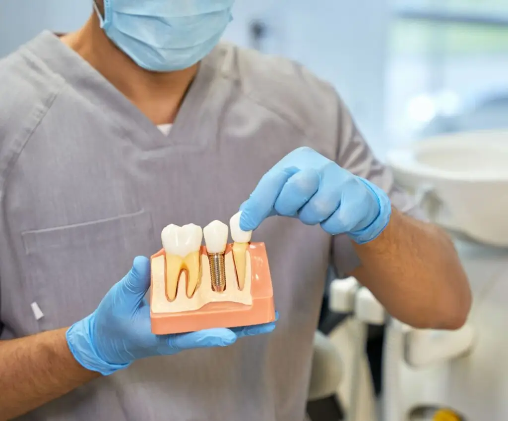Un odontolog sostiene un modelo didactico para explicar al paciente la diferencia entre un diente natural y un implante dental en un centro odontologico