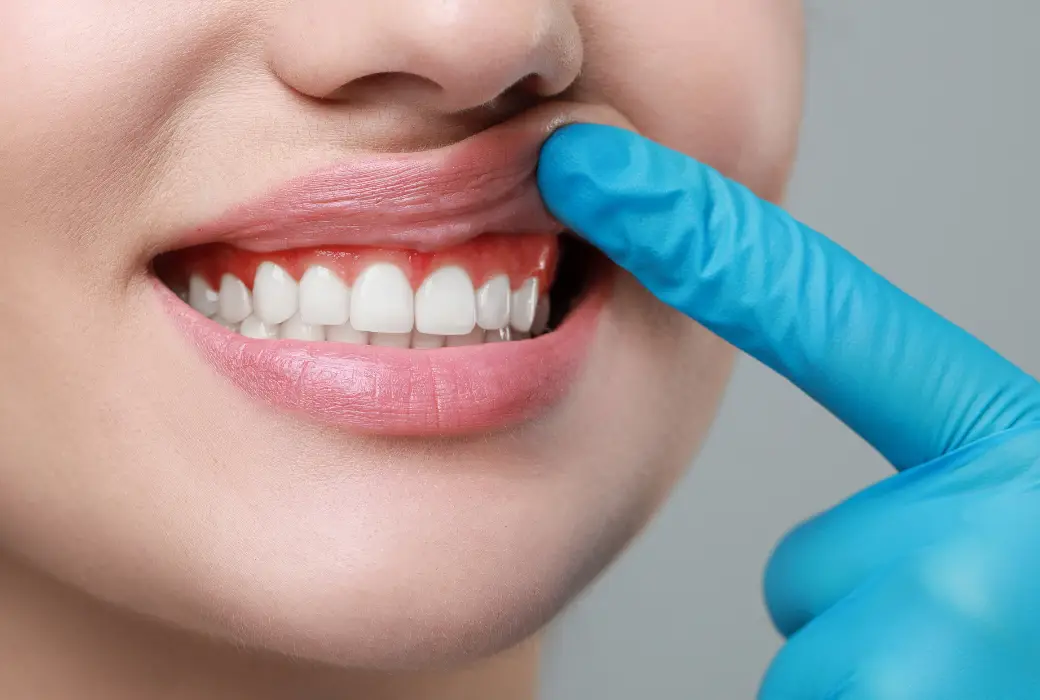 Verificacion clinica de la espcialidad de periodoncia para diagnosticar la salud y tratamiento requerido para las encias un paciente