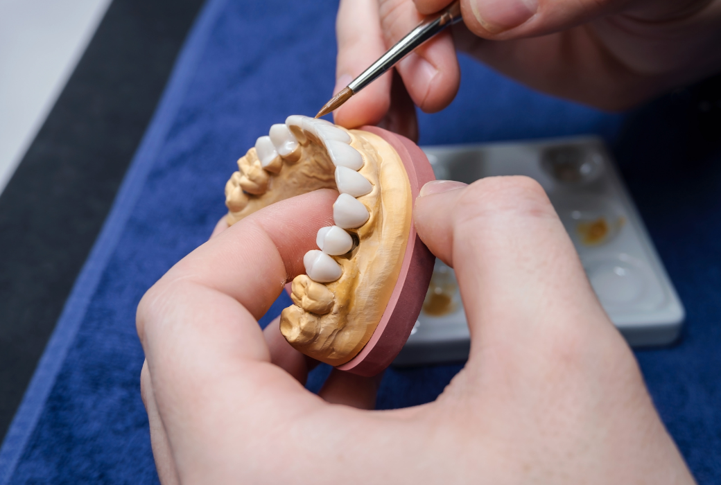 Imagen de un caso de prótesis dentales siendo terminado por el laboratorio dental en etapa de glaceado