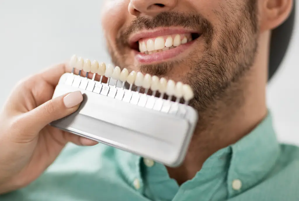 Paciente tomando tono dental para saber el tono inicial antes del blanqueamiento