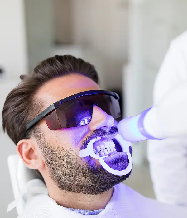 Paciente realizando blanqueamiento dental con lámpara LED en Belgrano Studio Dental
